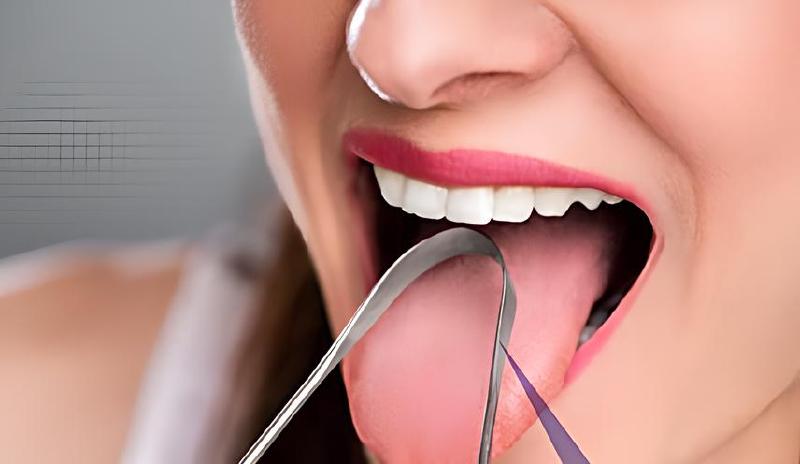 Imagen principal del artículo 'Las mejores herramientas para cuidado dental: Tonsil scoop, Raspador de lengua, Jeringa curvada + Protectores y férulas'